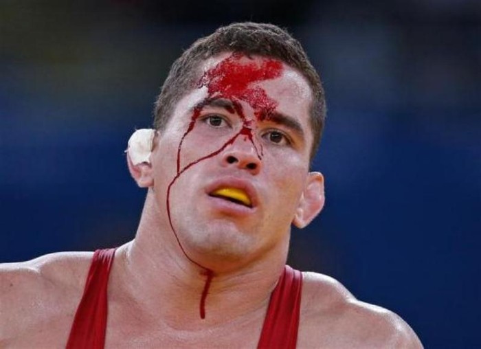 Ricardo Roberty Moreno (Venezuela) đổ máu trong một trận đấu vật tự do.